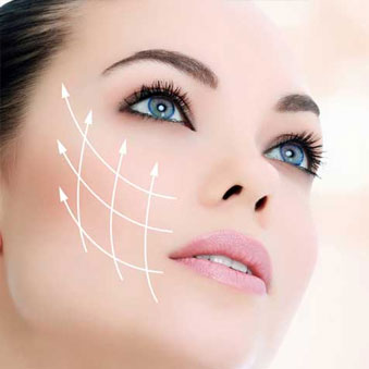 facelifting