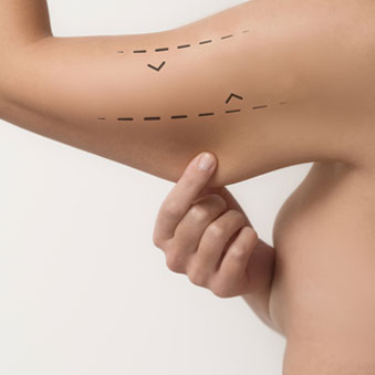 lipofilling-brazo